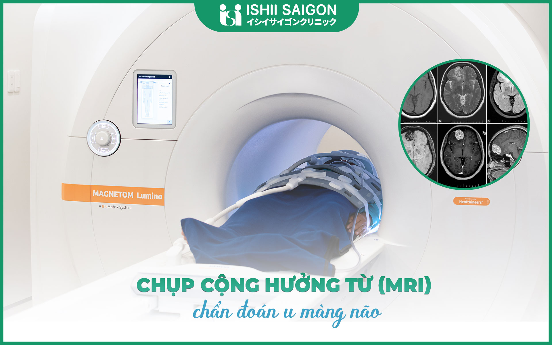 Chẩn đoán u màng não bằng chụp cộng hưởng từ MRI